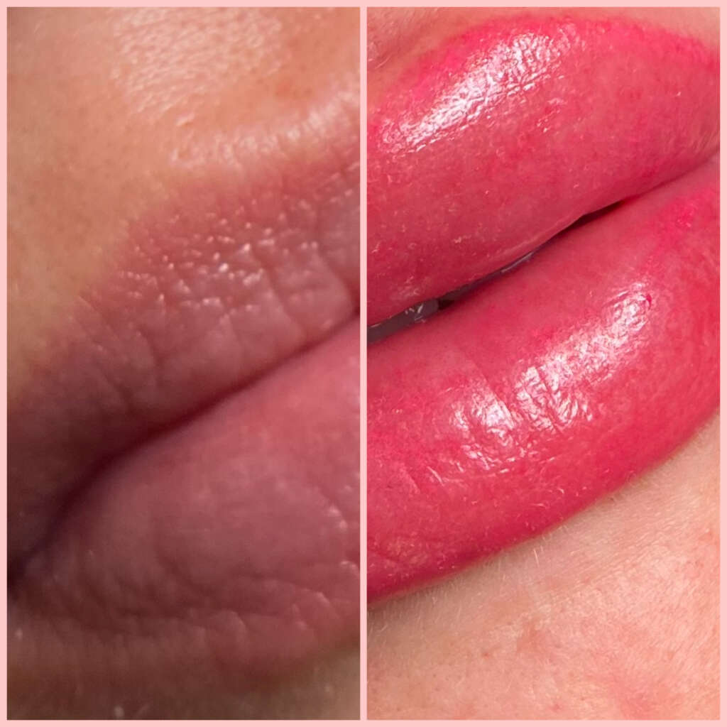 Lips